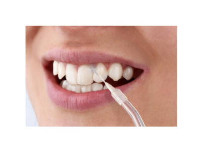 SOI 1311GD Ústna sprcha SENCOR